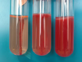 Motility Agar