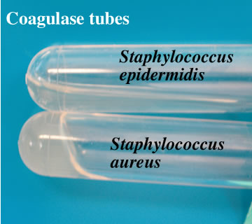 staphylococcus epidermidis streak plate