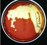 Picture of Beta Hemolysis