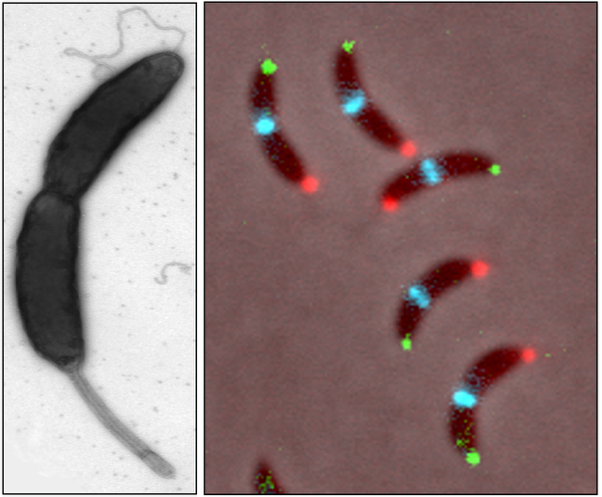 Cryo-electron microscope (left) and 3-color fluorescence microscope image (right) 