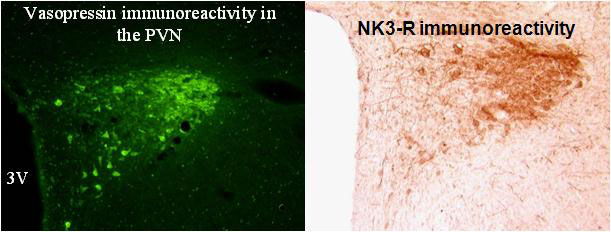 PVN immunoreactivity