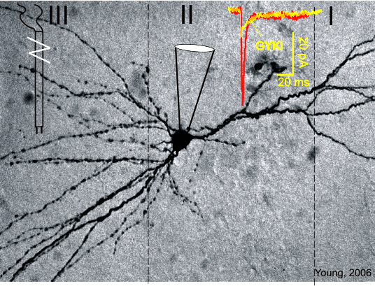 Pyamidal Neuron