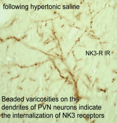 Nk3R saline