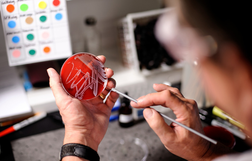 Scientist working with petri dish