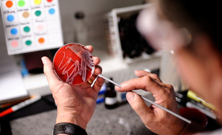 Scientist working with petri dish