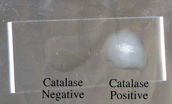 Catalase