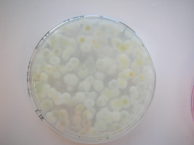 streptomyces