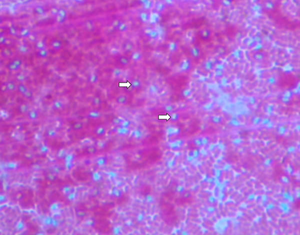 endospore stain