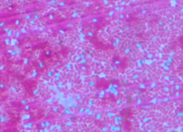 endospore stain