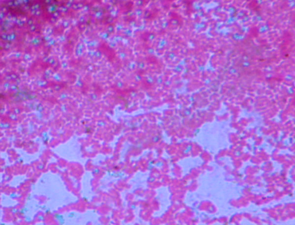 endospore stain