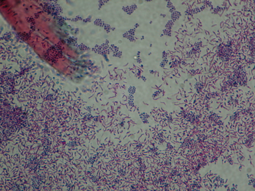 staphylococcus epidermidis gram stain