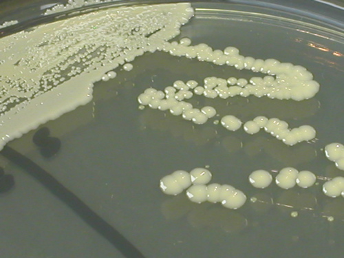 staphylococcus epidermidis streak plate