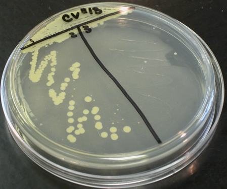 staphylococcus epidermidis streak plate