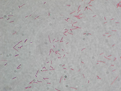 virtual unknown microbiology lab answers