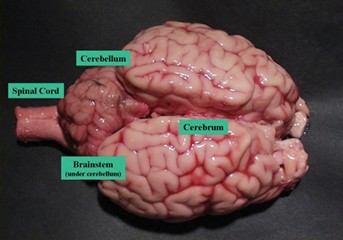 brain with section labels