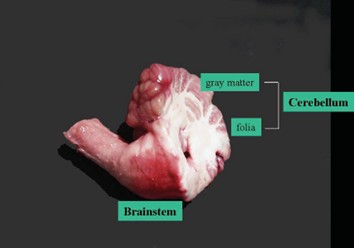 labeled brain cerebellum