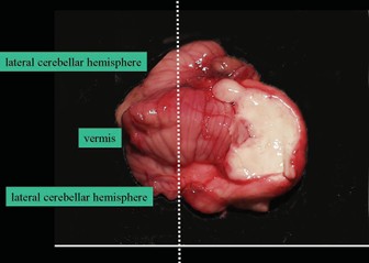 top cross-section of the cerebellum