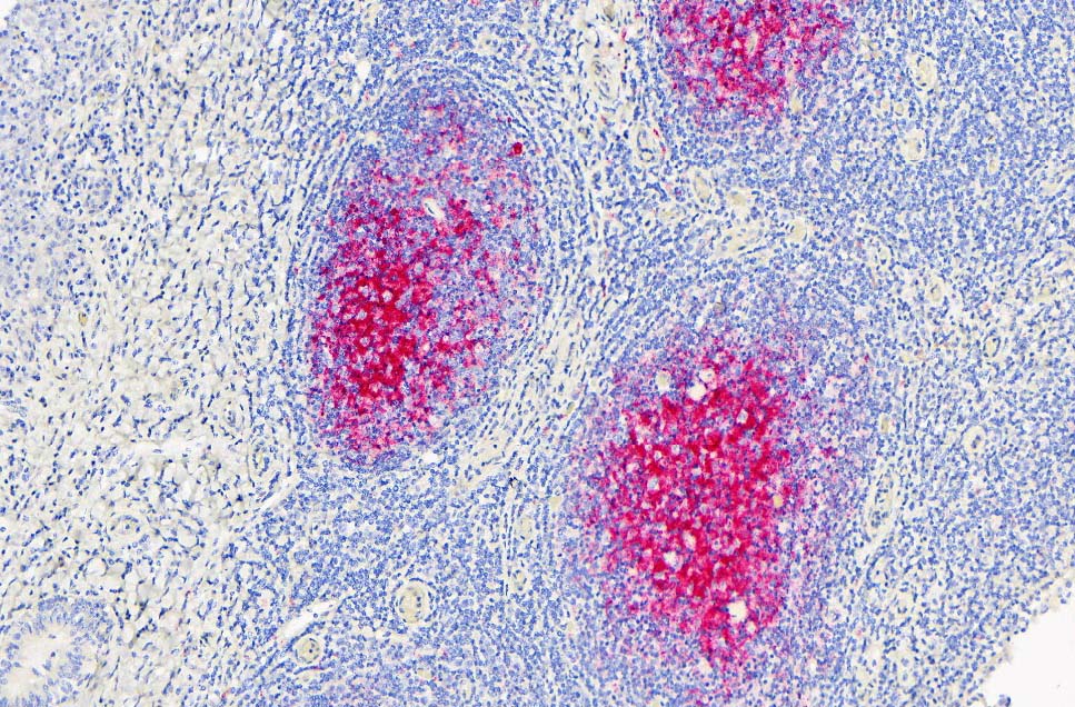 cwd immunohistochemistry staining