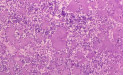 plague bacteria