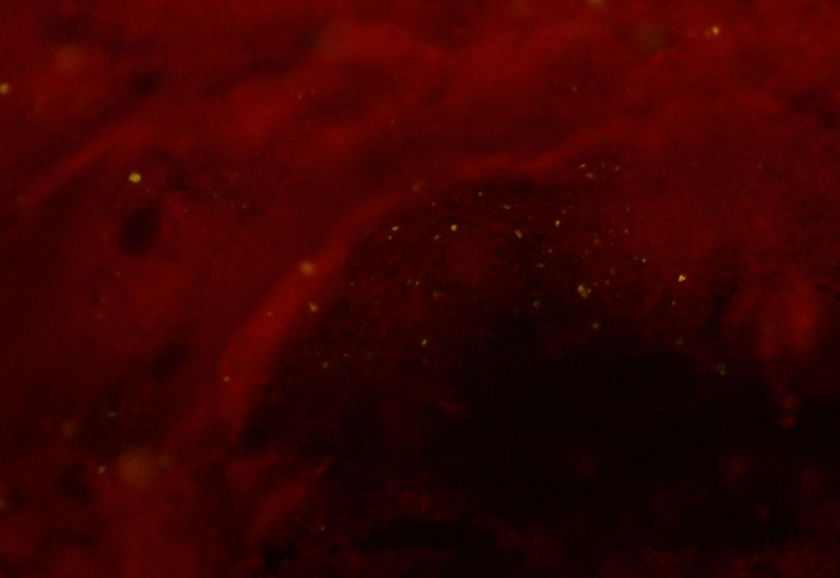 negative rabies image by direct fluorescent antibody (DFA) testing